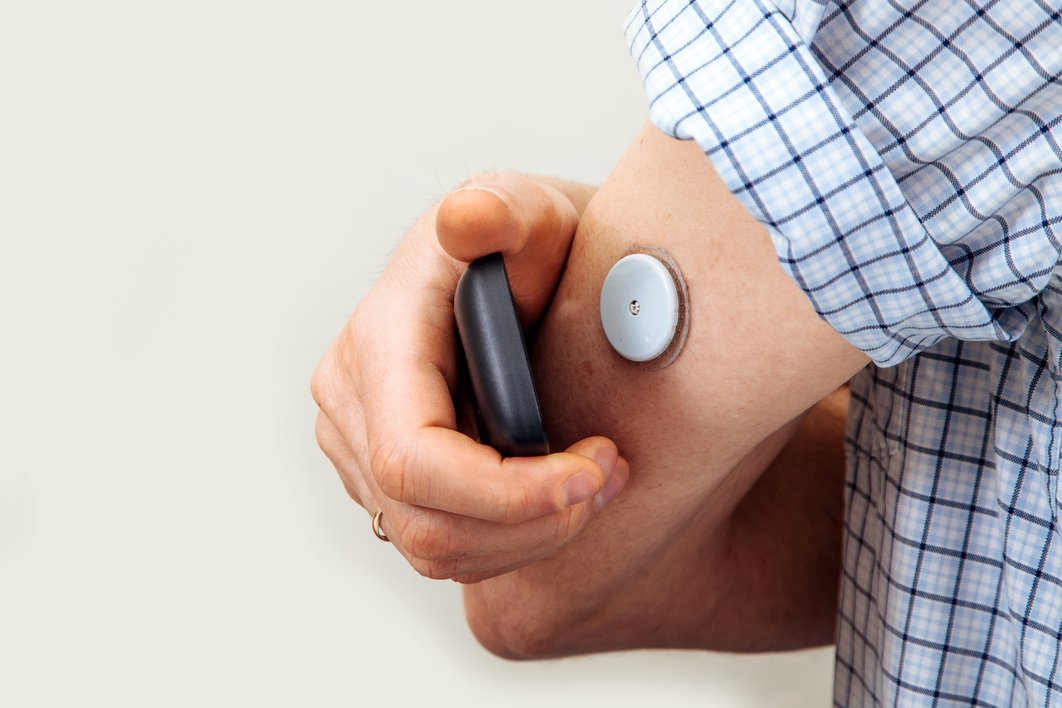 Glukosemessgerät an einem Arm - Kontrolle über ein Messgerät über Sensor am Arm